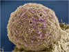 hiv infected cells 1