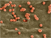 HIV Infected Cells